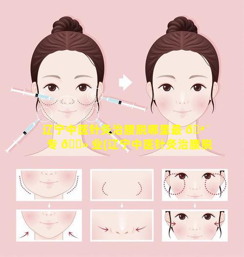 辽宁中医针灸治腰脱哪里最 🪴 专 🌻 业(辽宁中医针灸治腰脱哪里最专业的医生)